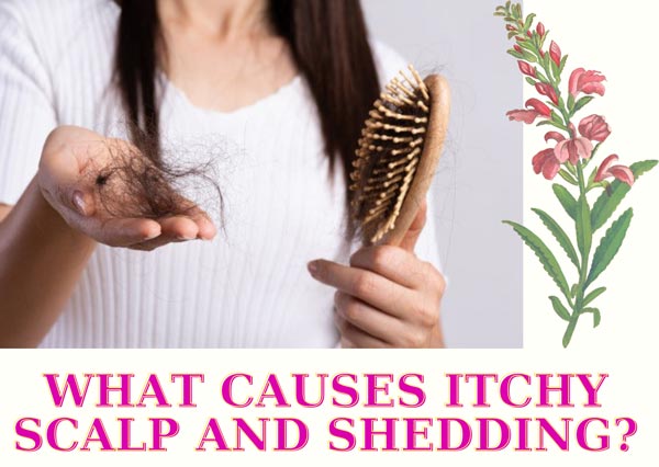 Causes Of Itchy Scalp With Shedding